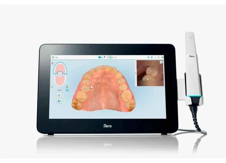iTero intraoral scanner for digital workflow